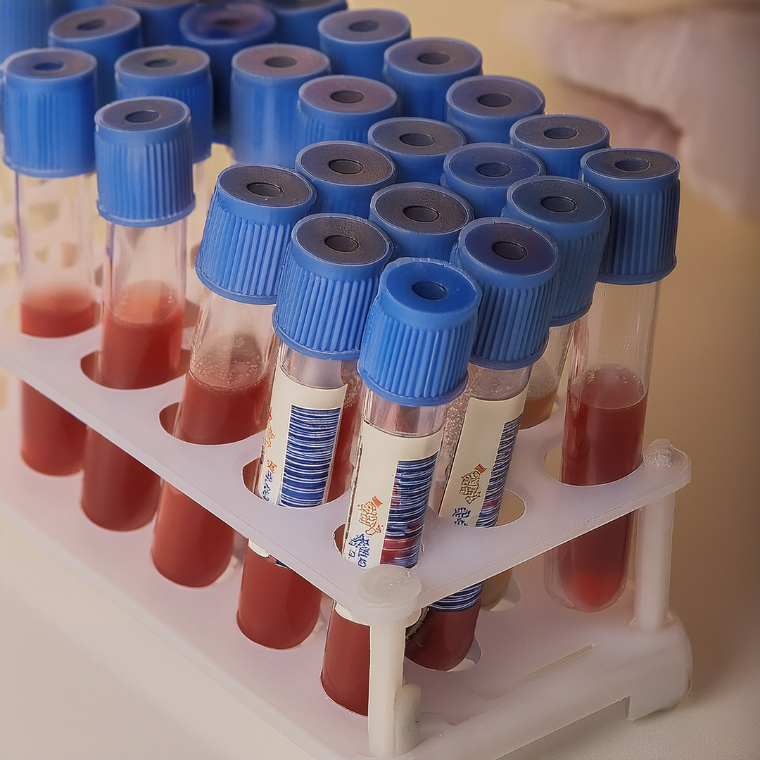Hematología