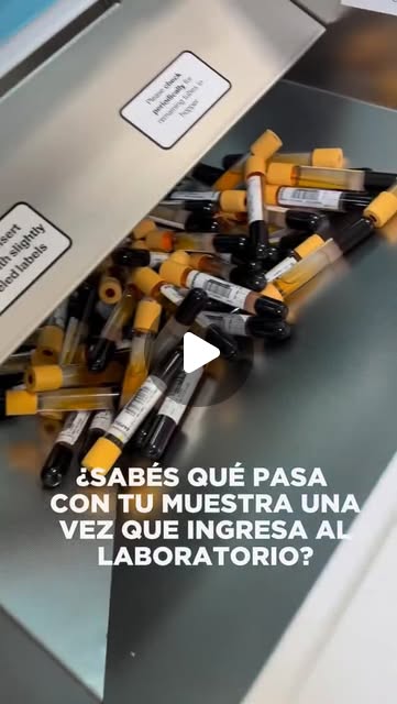 🔬 Descubre cómo ingresamos las muestras de suero al equipo preanalítico.